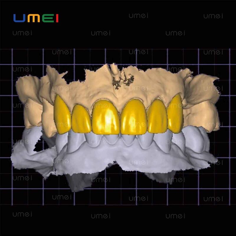 Full Mouth Teeth CAD Design Dental Precise Modeling For Cosmetic Dentistry